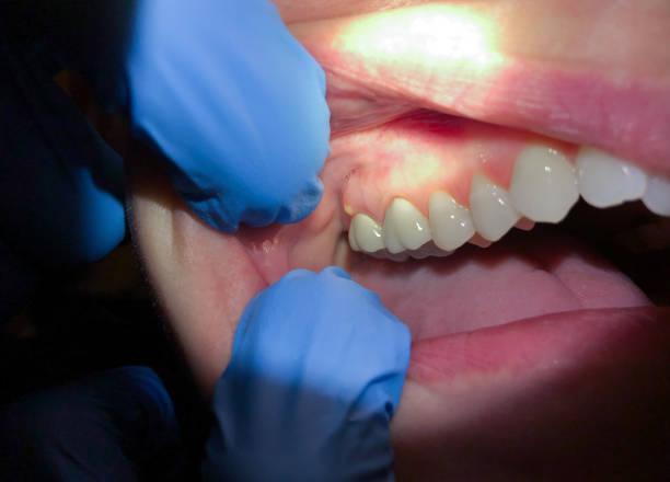 Best Emergency TMJ Treatment in Maize, KS