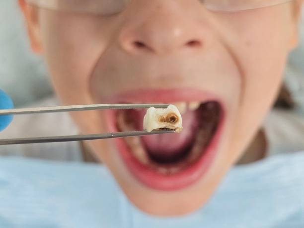 Best Emergency Denture Repair in Maize, KS